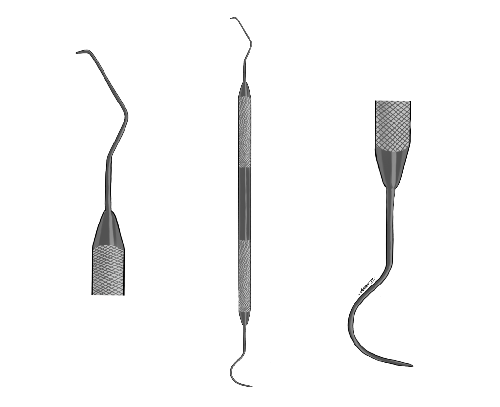 Amalgam Armamentarium - My Dental Key