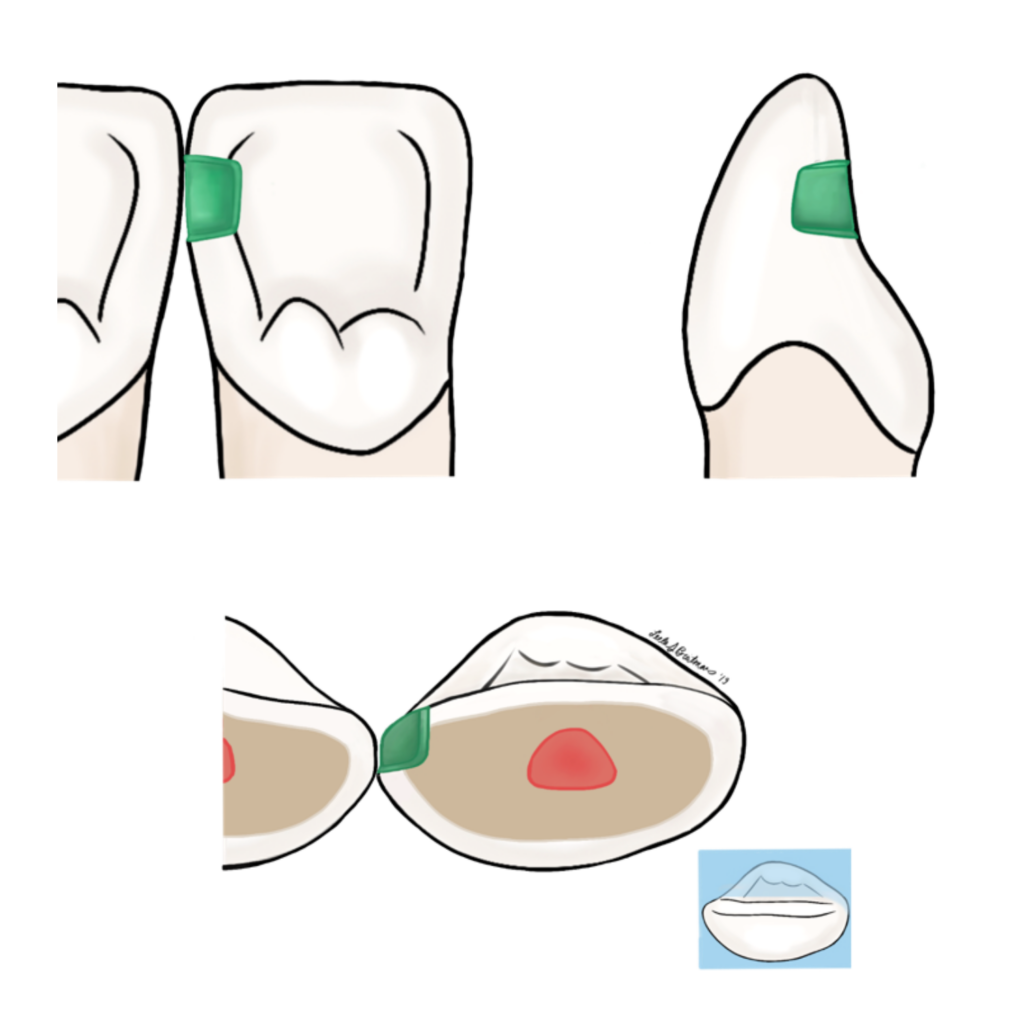 CDCA / ADEX My Dental Key