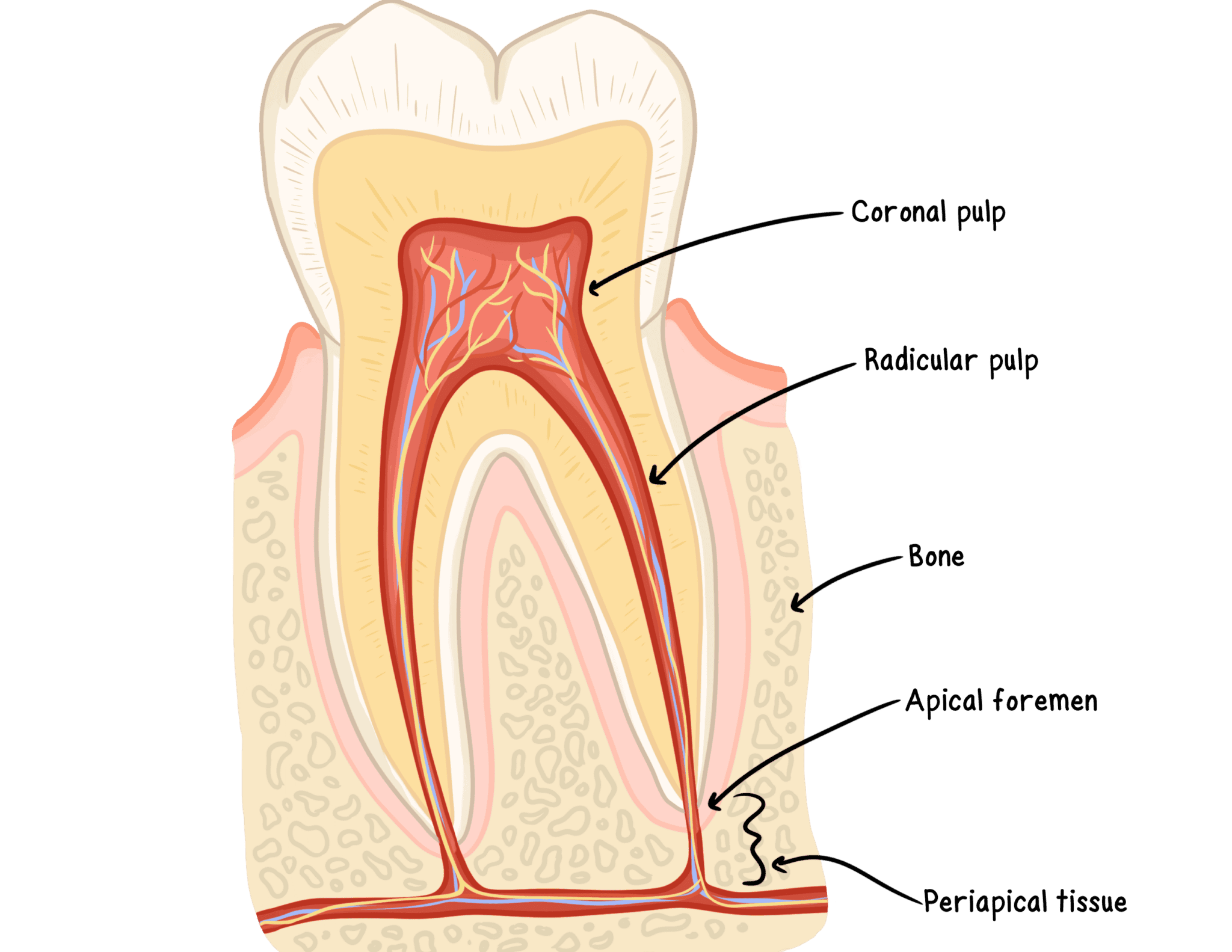 Pulpuctomy Pulpotomy vs. Pulpectomy - My Dental Key