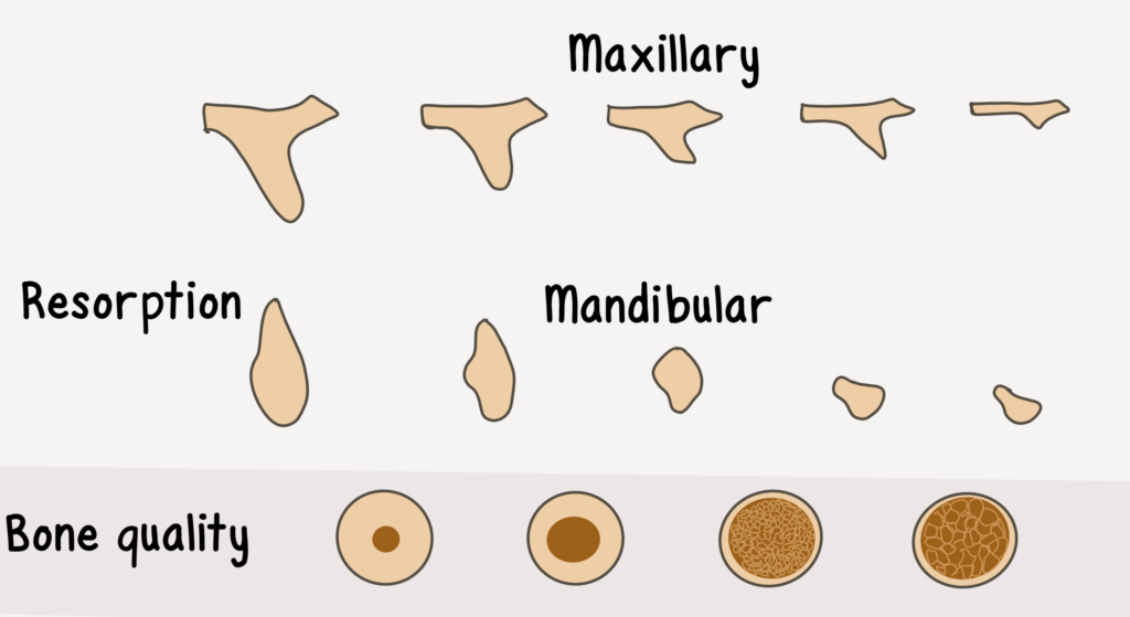 Socket Grafting Overview - My Dental Key