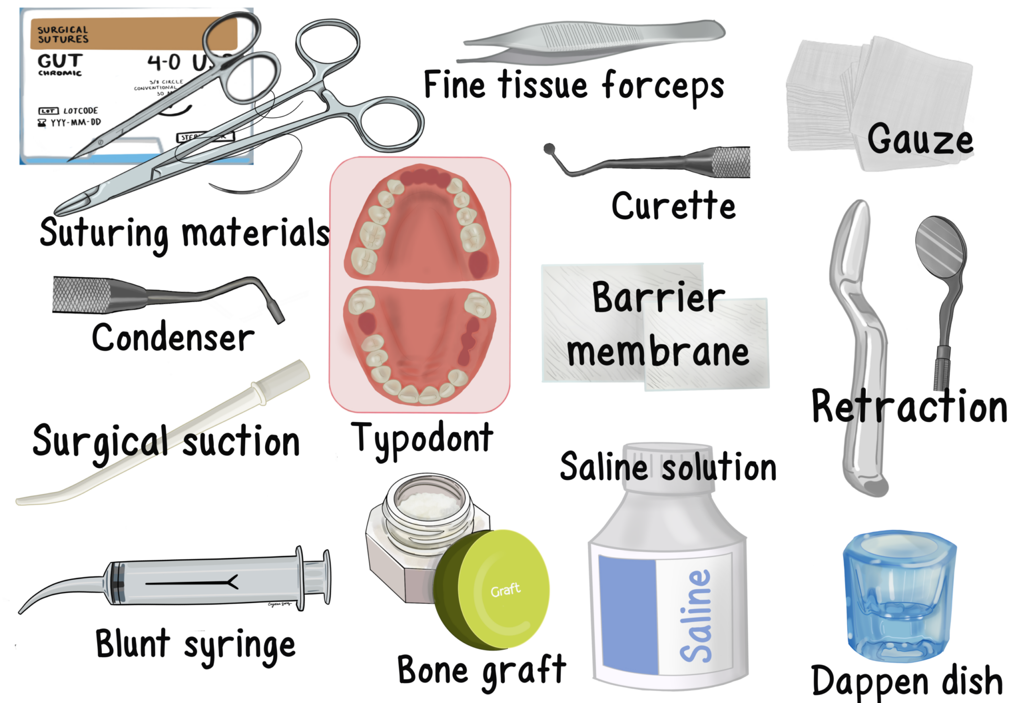 Socket Grafting Procedure - My Dental Key